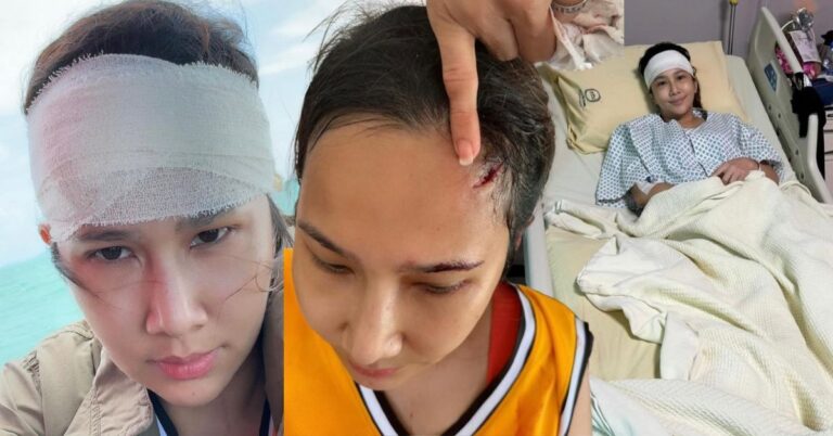 Percutian Bertukar Jadi Kemalangan, Dayana Roza Cedera, Darah Meleleh ‘Non Stop,’ Lega Dapat Selamatkan Anak