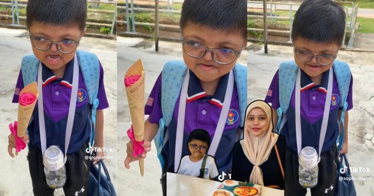 Anak Alami Sindrom Apert, Ibu Tak Mengalah Dengan Takdir, “Dia Pernah Tanya Mengapa Berbeza Dengan Kanak-kanak Lain”