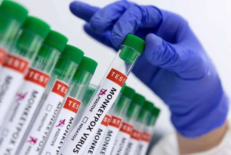 Pesakit Dalam Keadaan Stabil, Satu Kes Positive Mpox Clade 11 di Malaysia Dikesan – KKM