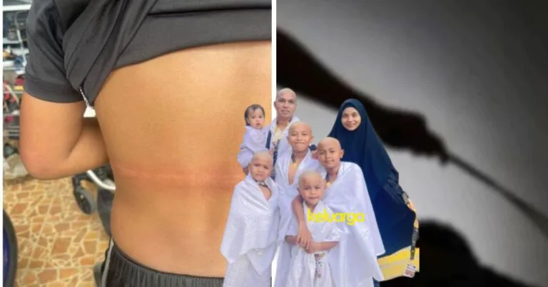 Ibu Terkejut, Anak Kena ‘Libas’, Kaki Menggigil Ketakutan Waktu Solat Jumaat