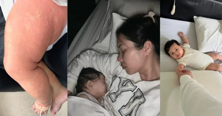 Zahirah Macwilson Beri Semula Susu Badan Pada Anak, Alami Ekzema & Alahan Protein Susu Lembu