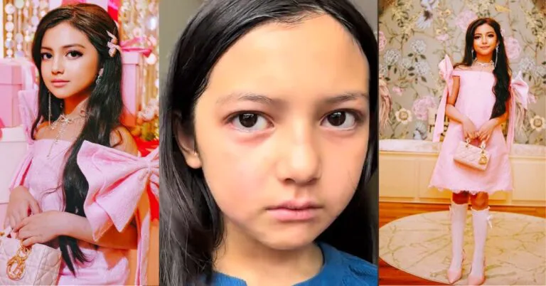 Muka Aaisyah Bengkak-bengkak, Che Ta Baru Tahu Anak Tak Boleh Makan Ketam