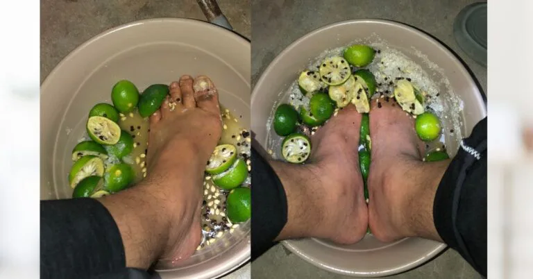 Demam Virus Tak Kebah-kebah Lebih Seminggu, Lelaki Ini Kongsi Penawarnya