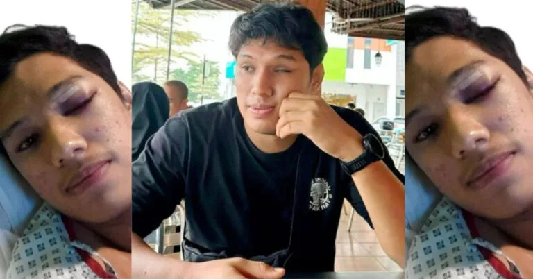 Buta Sebelah Mata Dibaling Mainan, Pemuda 29 Tahun Kini OKU Penglihatan