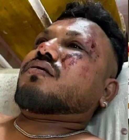 Pengakuan Mangsa Tunggal Terselamat Nahas Pesawat Air India – “Saya Terus Bangun Dan Lari”
