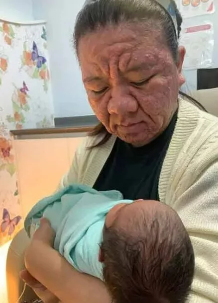 Pernah Tular Wajah Berkedut Ketika Hamil, Lala Kongsi Keadaan Selepas Bersalin, Bukan Penyakit Ain