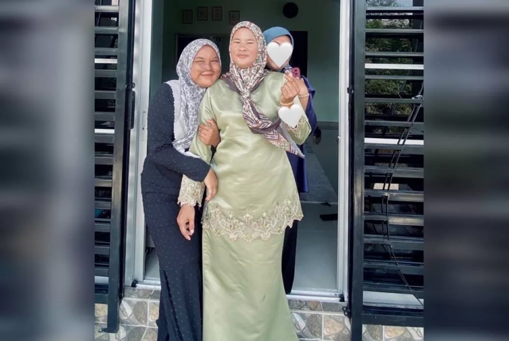 Gadis Mangsa Disimbah Cuka Getah Tak Pernah Berdendam Perbuatan Bapa, Jalani Pembedahan Hidung