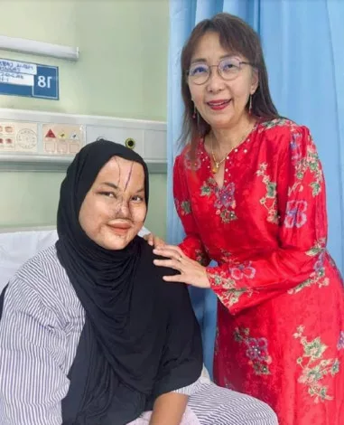 Gadis Mangsa Disimbah Cuka Getah Tak Pernah Berdendam Perbuatan Bapa, Jalani Pembedahan Hidung