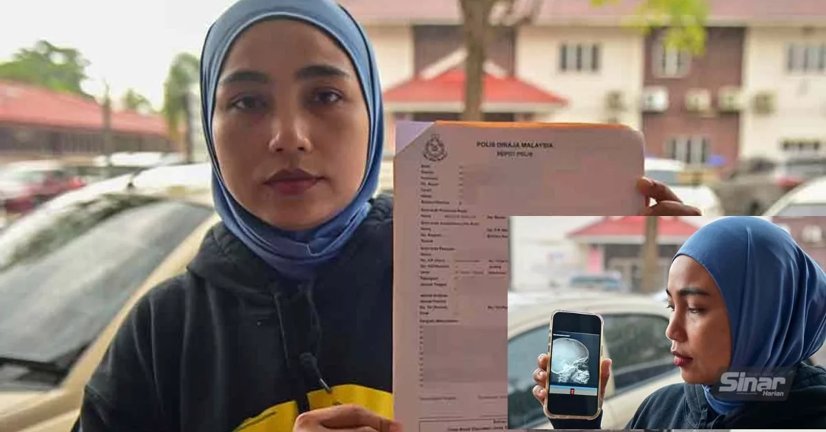 Murid Tahun Dua Patah Tulang Hidung, Retak Tulang Bahagian Mata Akibat Dipukul Rakan Sekolah