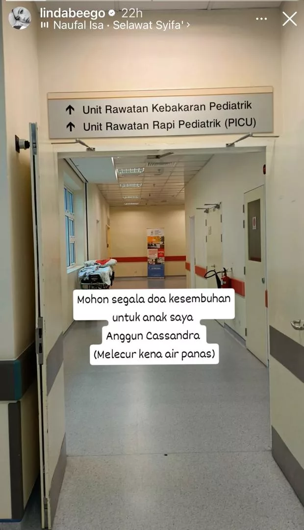 Anak Kedua Linda Hashim Masuk Hospital, Melecur Terkena Air Panas – “Doakan Kesembuhan Untuk Anggun Cassandra’