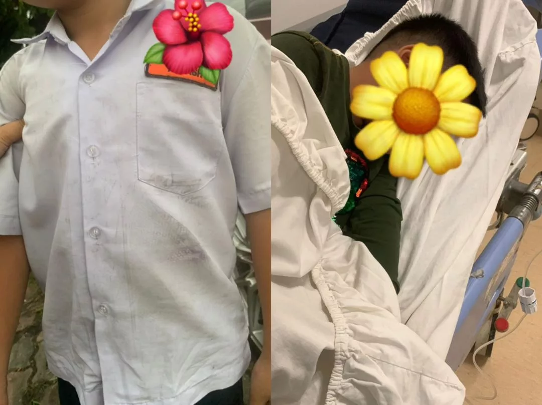 Kes Buli Sekolah Mengejutkan Di Shah Alam: Murid Tahun Satu Cedera Dipukul