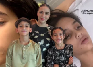 Anak Diana Danielle Alami Lumpuh Wajah, Ibu Rayu Doa Demi Kesembuhan Penuh