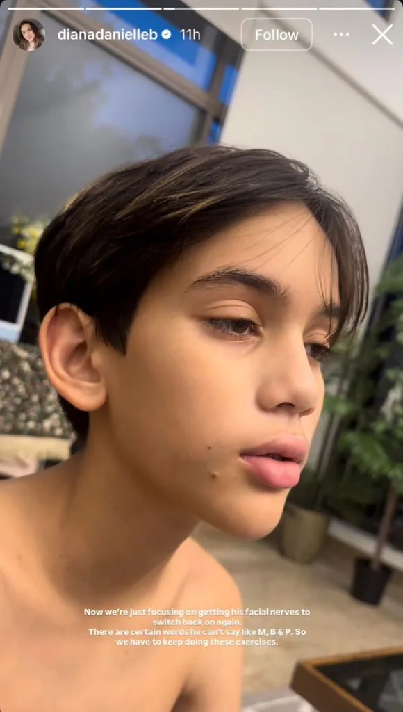 Anak Diana Danielle Alami Lumpuh Wajah Dan Sukar Sebut Huruf, “Doakan Anak Saya…”