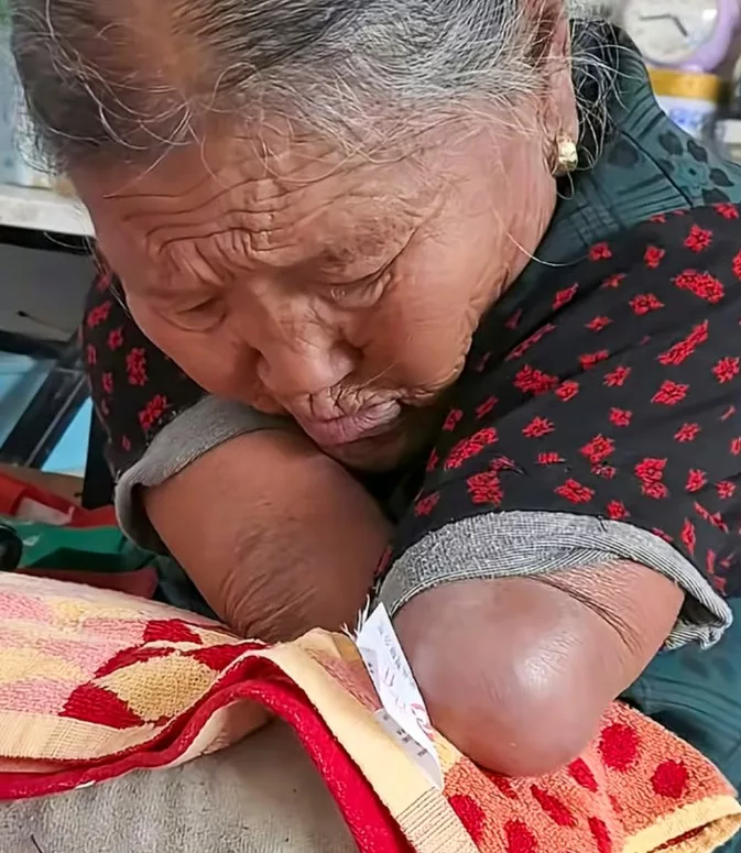 Ibu Cekal Besarkan 3 Anak Walau Dilahirkan Tanpa Kaki Dan Tangan