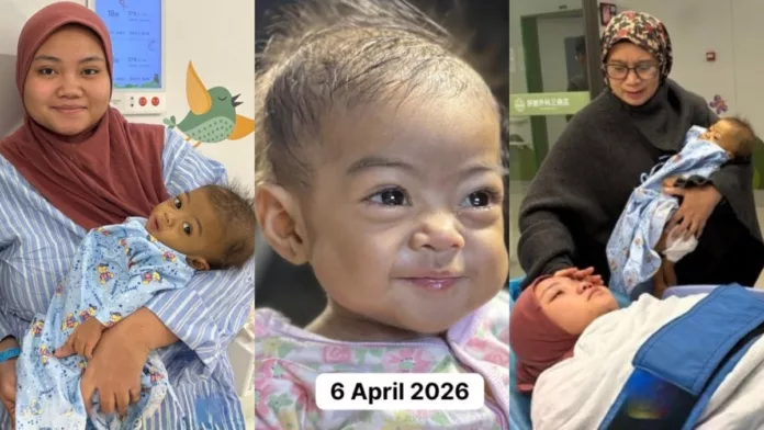 pemindahan hati Chempaka Naura