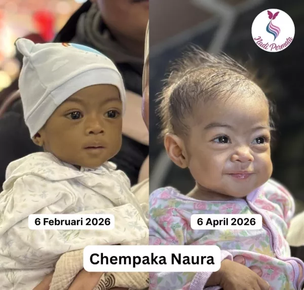 Pemindahan Hati Chempaka Naura! Kisah Menyentuh Hati Pengorbanan Luar Biasa Seorang Ibu 4 Pemindahan Hati Chempaka Naura! Kisah Menyentuh Hati Pengorbanan Luar Biasa Seorang Ibu