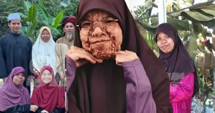 Kulit Berbiji
